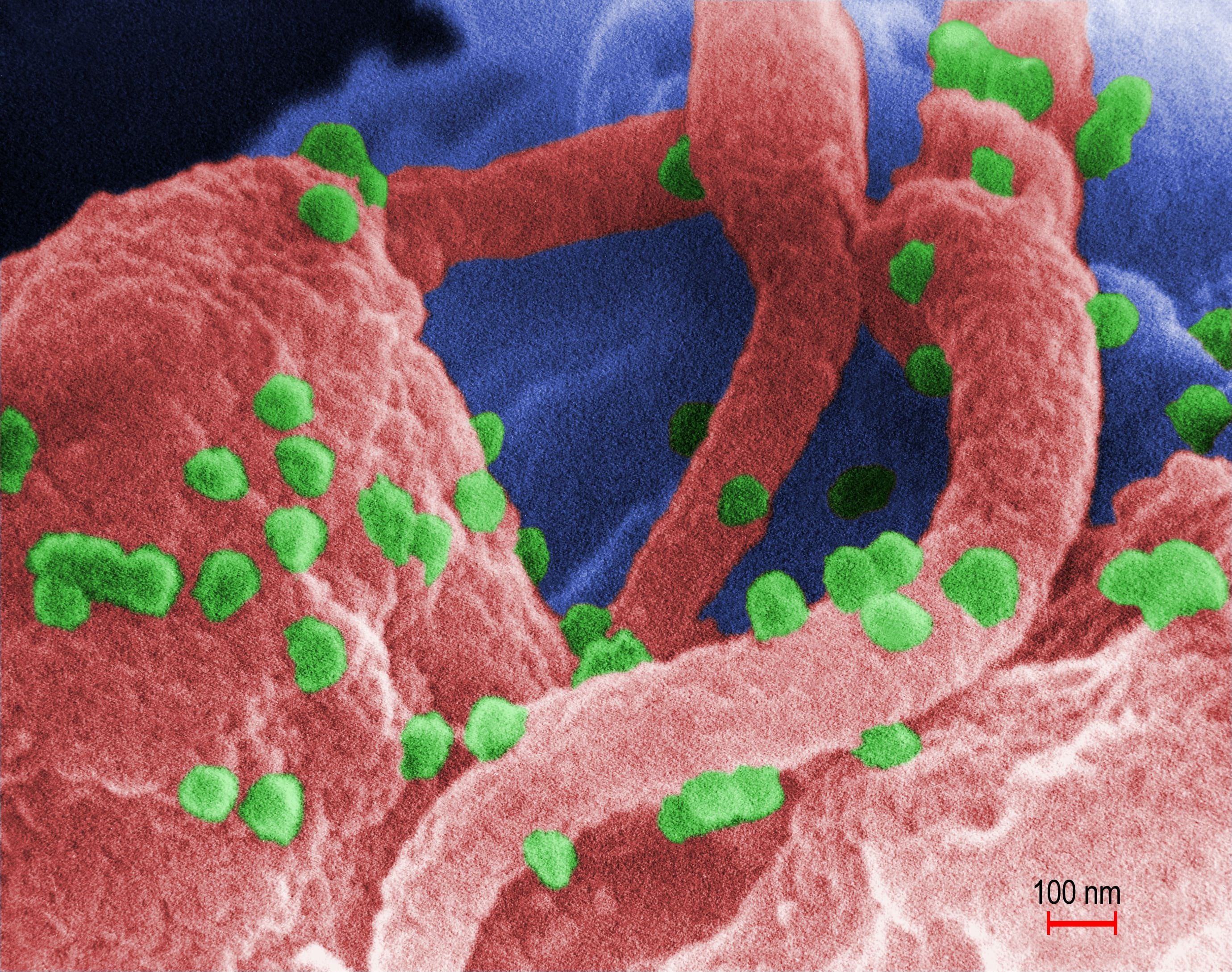 CDC image of HIV-1 virons budding from a cultured human lymphocytes