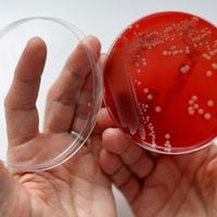 Médicos y científicos creen haber encontrado la razón tras mortal avance de la “bacteria asesina”