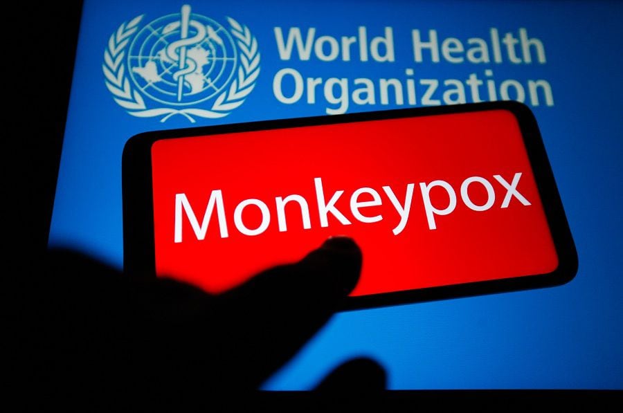 Monkeypox photo illustration, in Ukraine - 21 May 2022