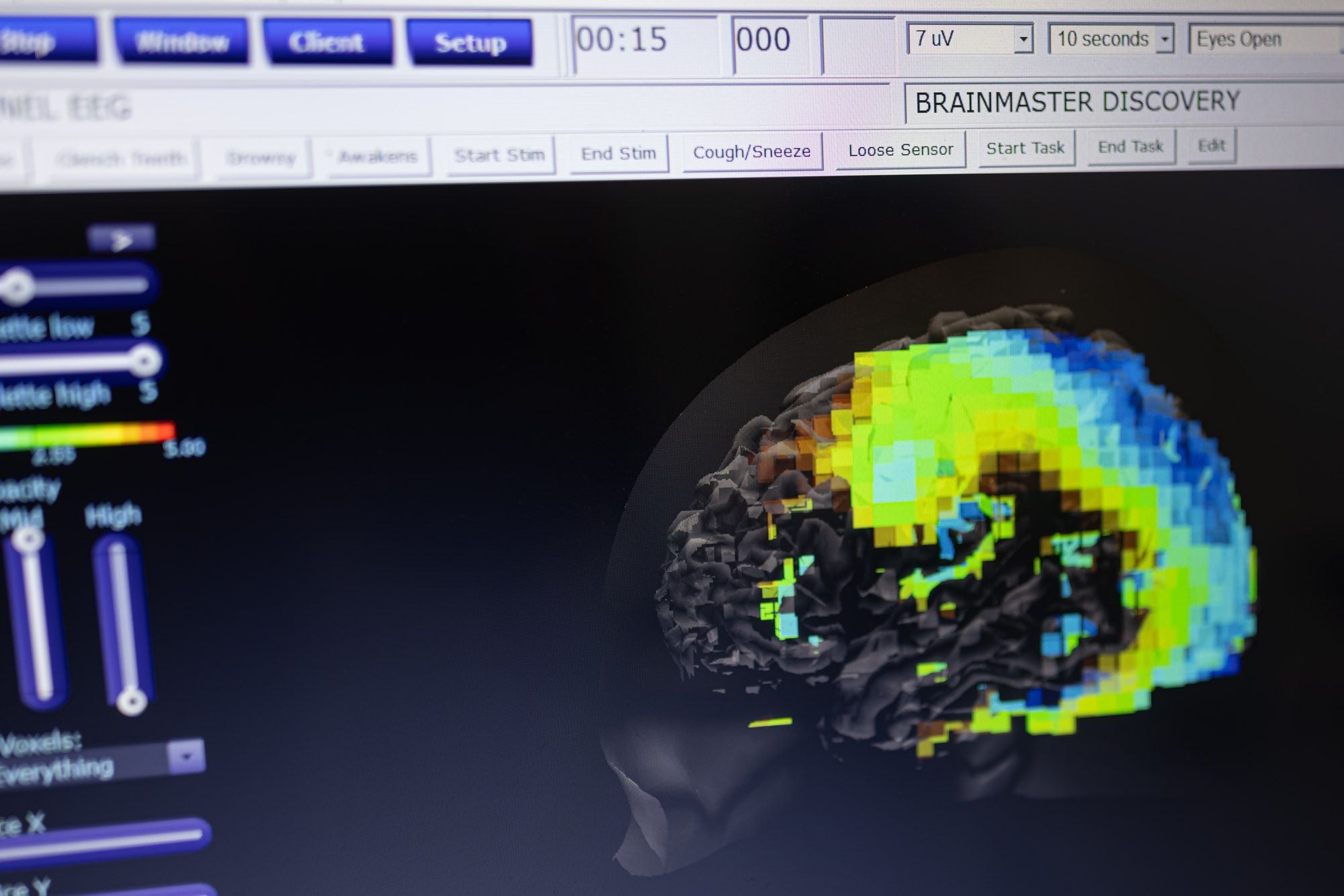 Andes Neurofeedback