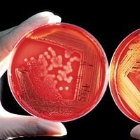 Aumentan muertes por bacteria carnívora y científicos temen que pueda salirse de control