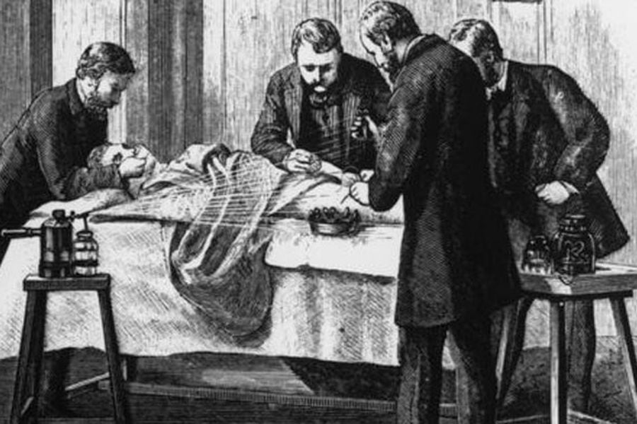 Sádico o salvador?: quién fue J. Marion Sims, el médico que hizo cirugías  vaginales sin anestesia en esclavas negras y es considerado el 