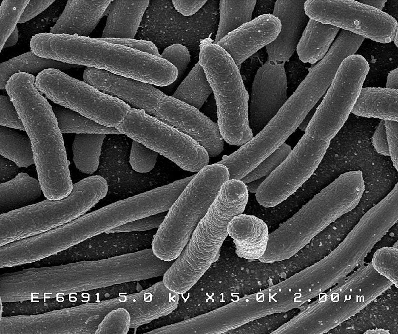 escherichia coli