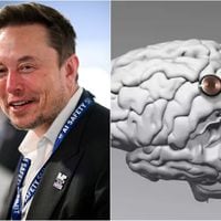 Neuralink volverá a implantar un chip cerebral: estos son los “superpoderes” que anunció Elon Musk