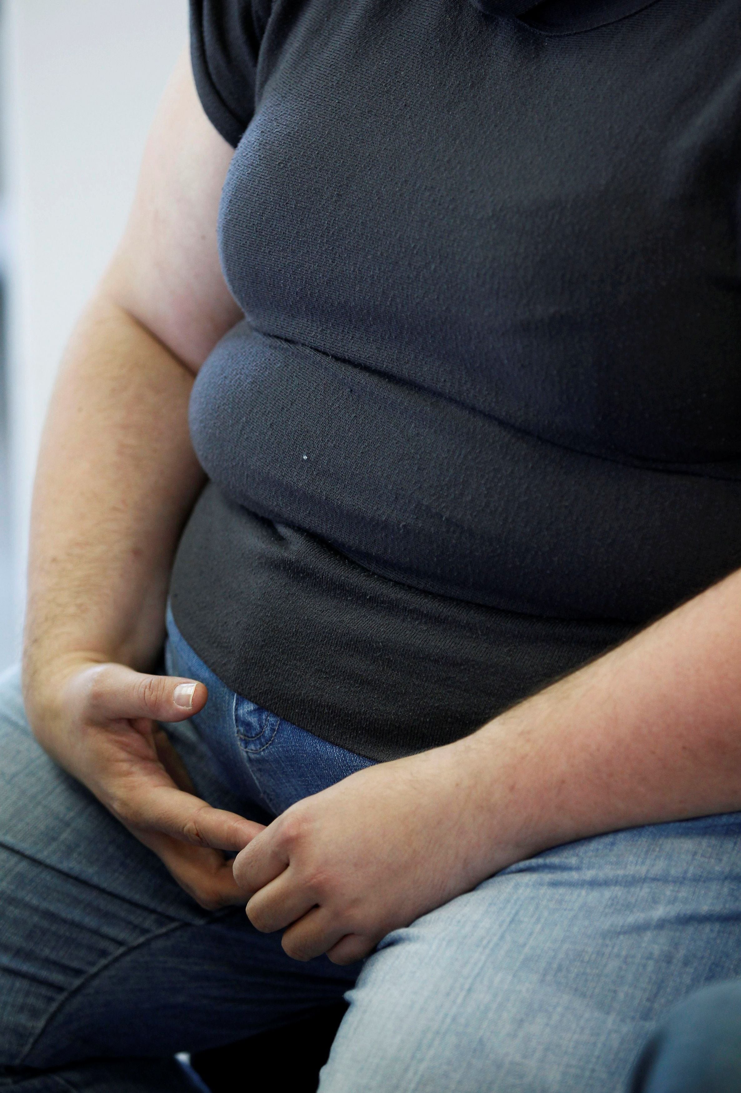 FILE PHOTO: An obese patient speaks with surgeon Dr Alexandre Lesage in his office to prepare for surgery at the Saint Jean d'Angely Hospital