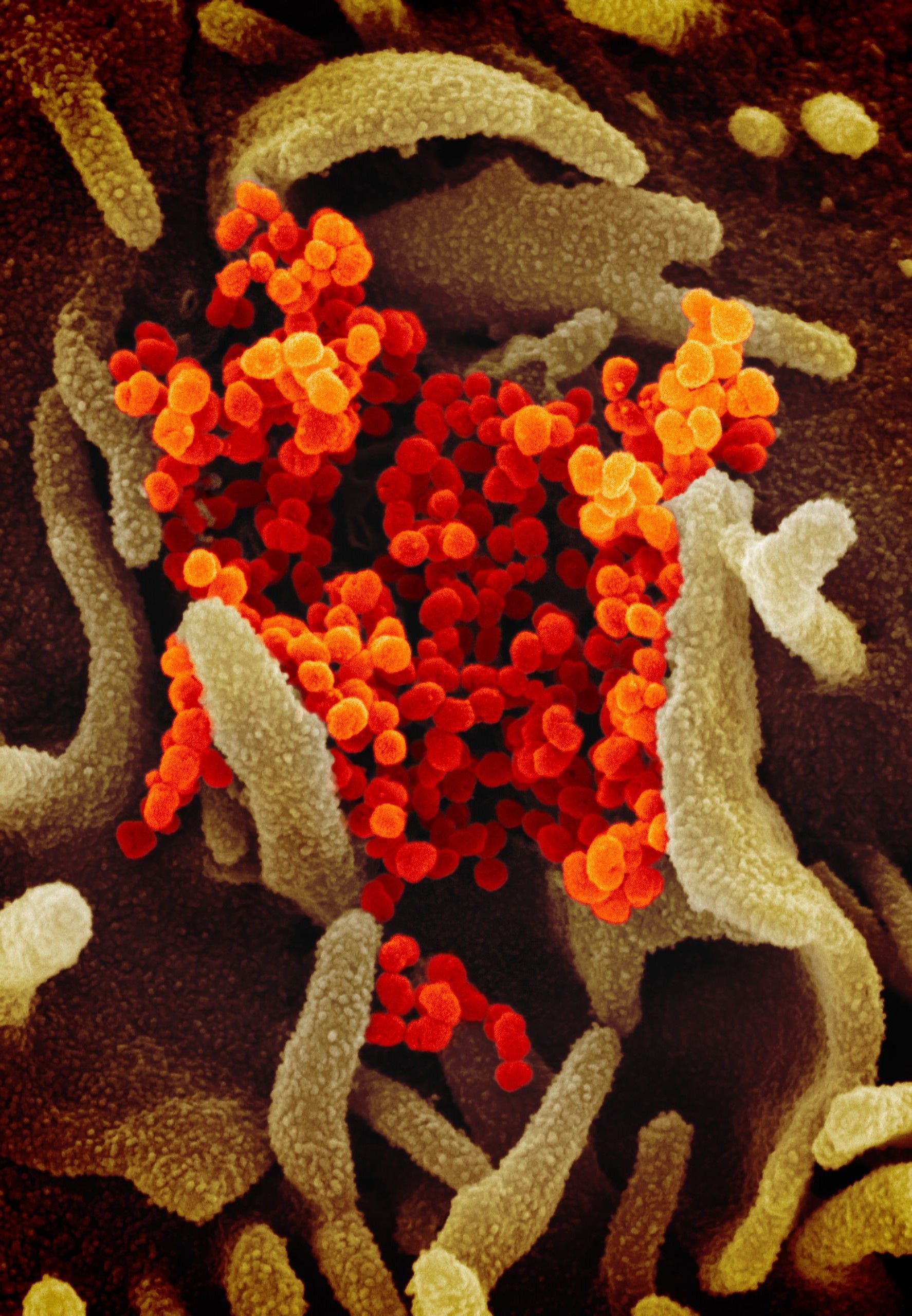 Electron microscope image the new coronavirus, SARS-CoV-2 (February 2020)Coronavirus Niaid Rml 49531042907 531f7f1186 O