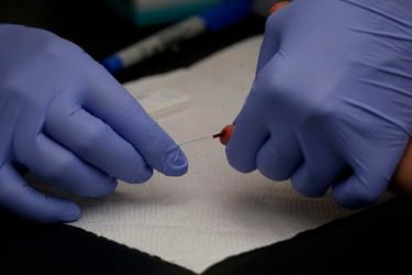 Diputados se someten a test rápido del VIH en la Universidad de Chile