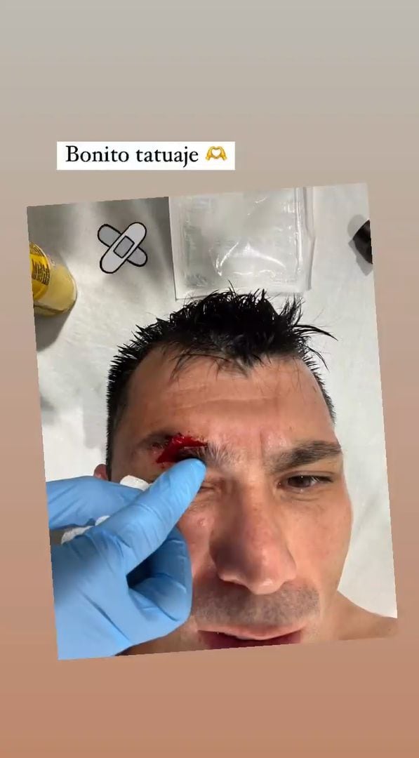 Esta fue la historia que subió a su cuenta de Instagram, Gary Medel, tras el choque con Zlatan Ibrahimović,