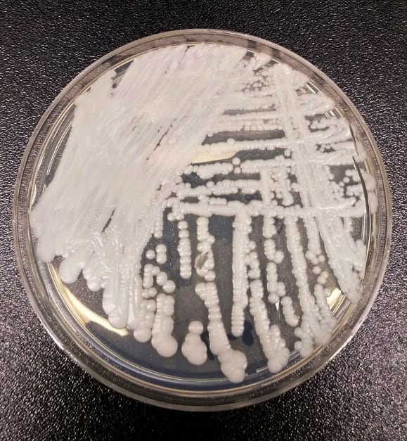 Candida Auris