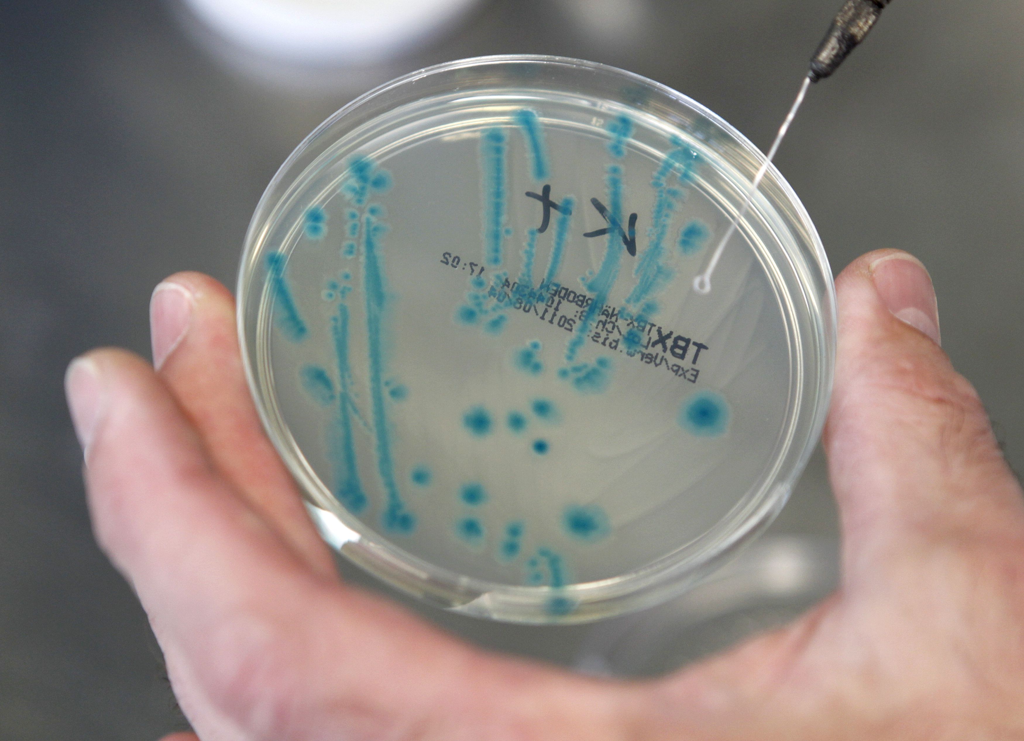 An Austrian scientist holds petri dish with bacterial strains of EHEC bacteria in the microbiological laboratory of the Austrian Agency for Health and Food Safety in Vienna