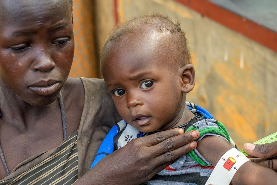 Mortalidad Infantil En África: 60 Millones De Niños Pasan Hambre - La ...