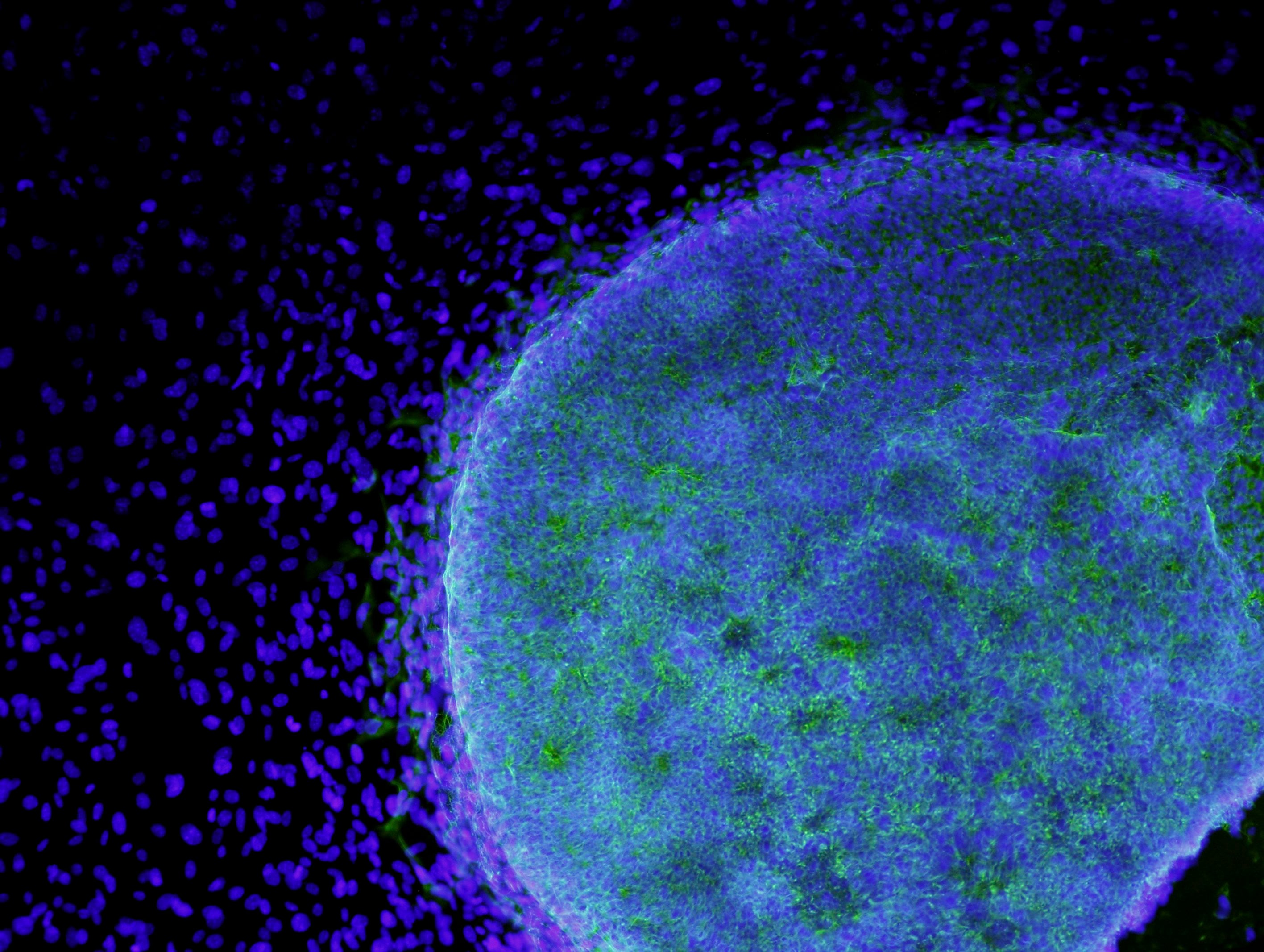 A microscopic view shows a colony of human embryonic stem cells growing on fibroblasts in this handout photo