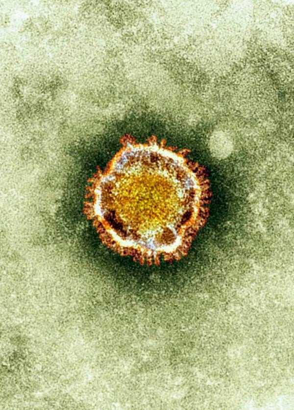 A electron microscope image of a coronavirus is seen in this undated picture provided by the Health Protection Agency in London