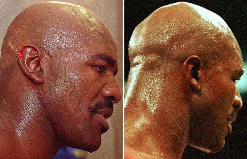 Mancha imborrable: a 20 años de la famosa mordida de Mike Tyson - La