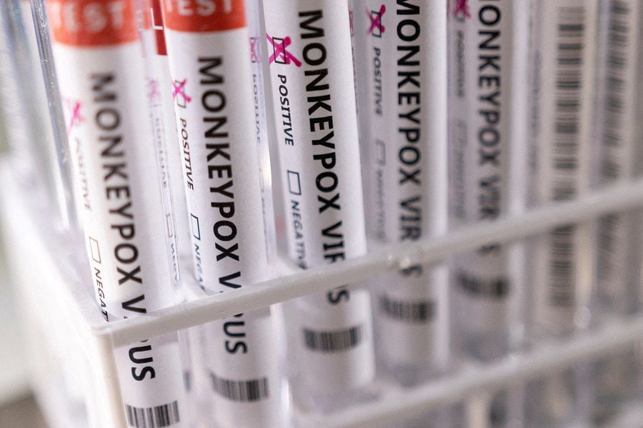 FILE PHOTO: Illustration shows test tubes labelled "Monkeypox virus positive\