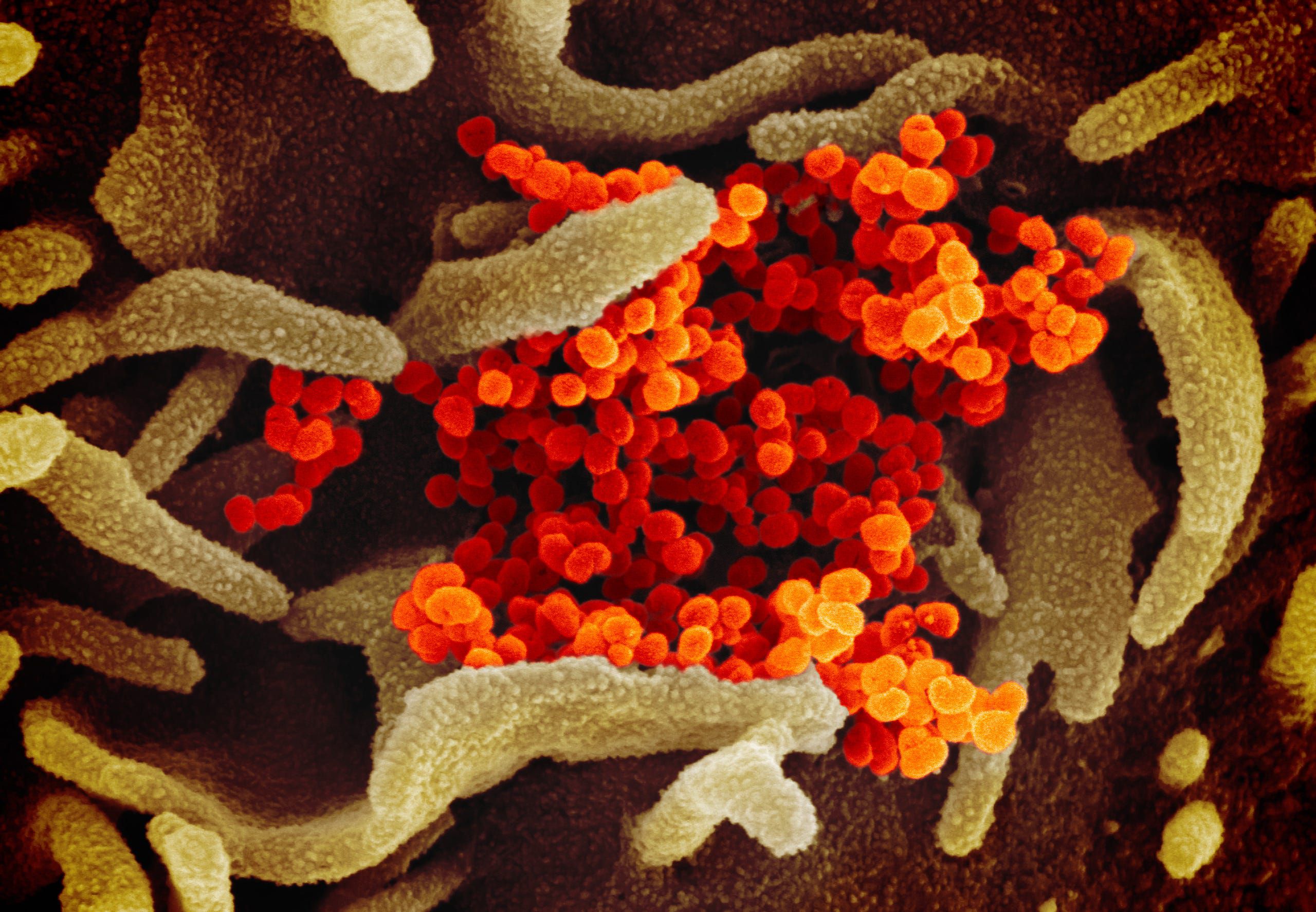 Electron microscope image the new coronavirus, SARS-CoV-2 (February 2020)Coronavirus Niaid Rml 49531042907 531f7f1186 O